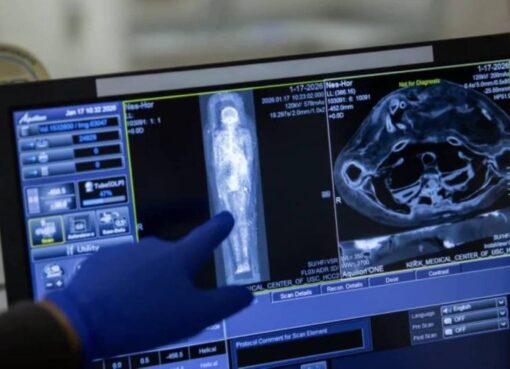 تقنيات التصوير الطبي للمومياءات المصرية