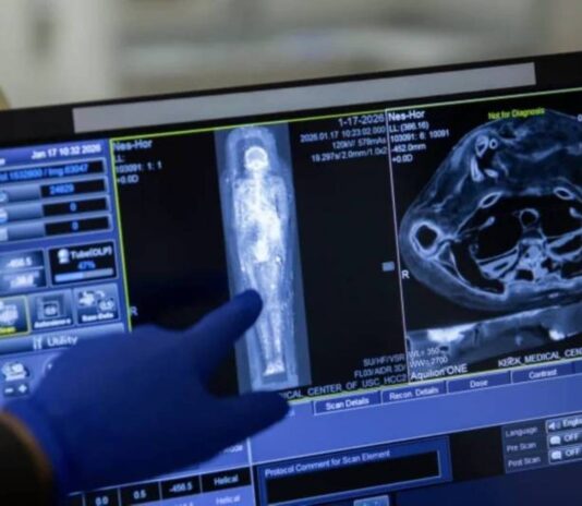 تقنيات التصوير الطبي للمومياءات المصرية